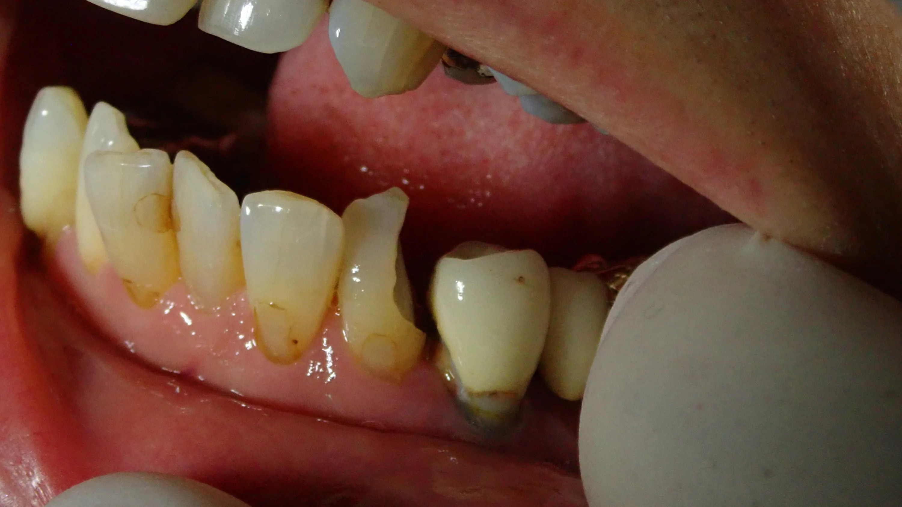 ブログ・お役立ち情報｜坂寄歯科医院（取手市藤代）