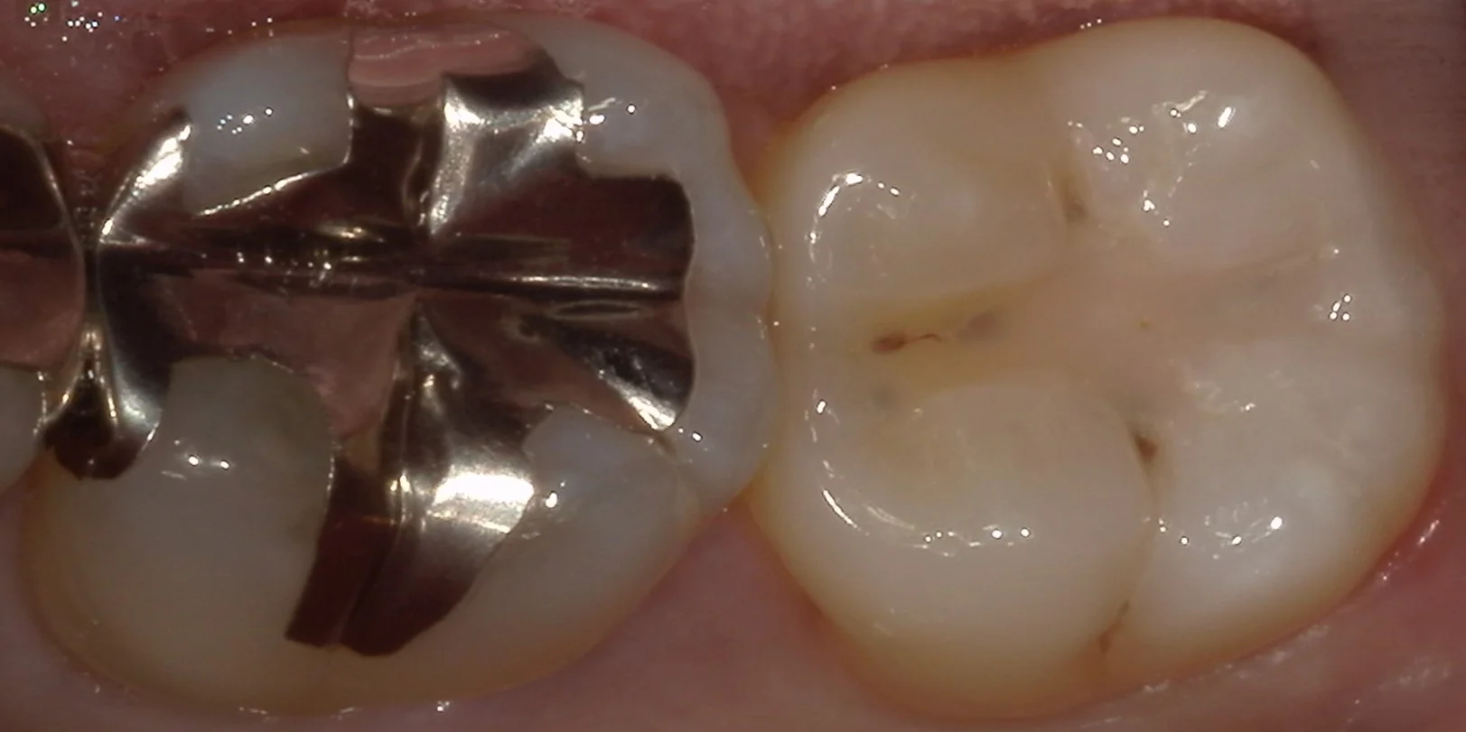 ブログ・お役立ち情報｜坂寄歯科医院（取手市藤代）