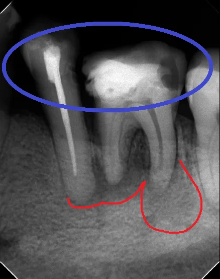 ブログ・お役立ち情報｜坂寄歯科医院（取手市藤代）