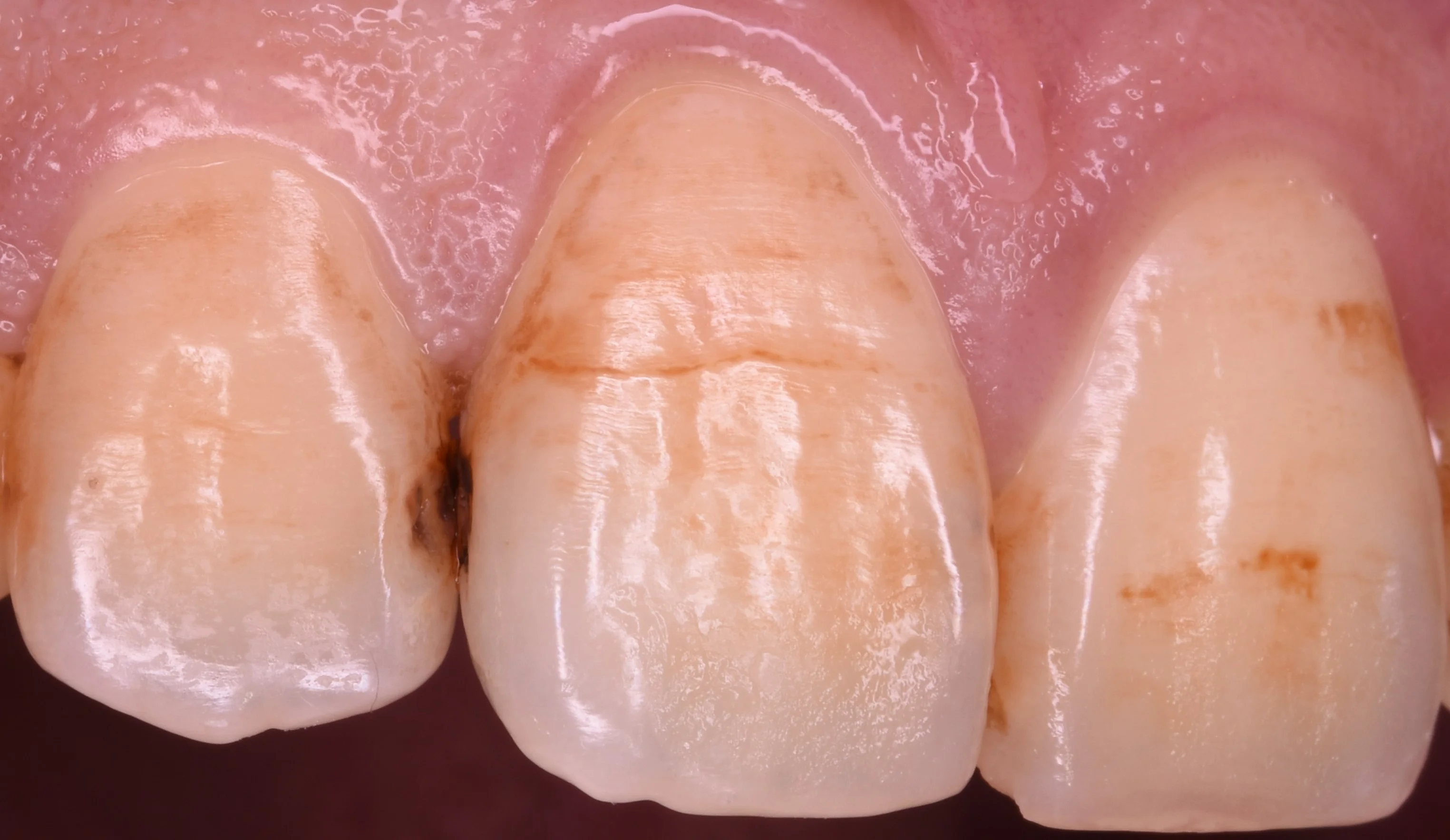 ブログ・お役立ち情報｜坂寄歯科医院（取手市藤代）