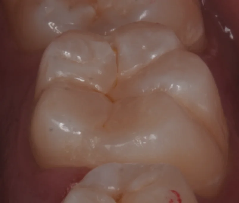 歯学部生をダイレクトで。｜坂寄歯科医院（取手市藤代） - 画像6