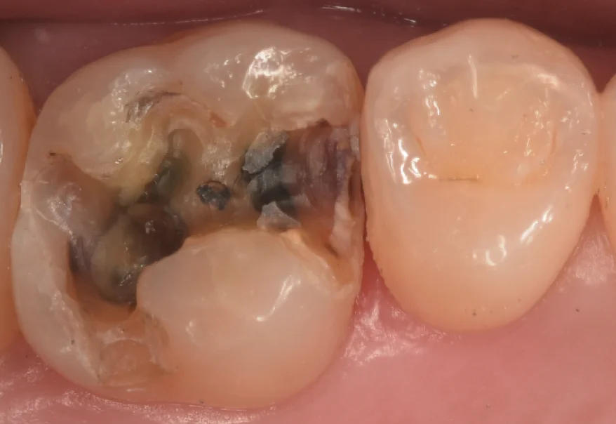 千葉県からお越しの方｜坂寄歯科医院（取手市藤代） - 画像2