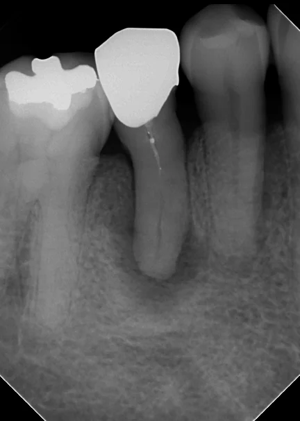 ブログ・お役立ち情報｜坂寄歯科医院（取手市藤代）