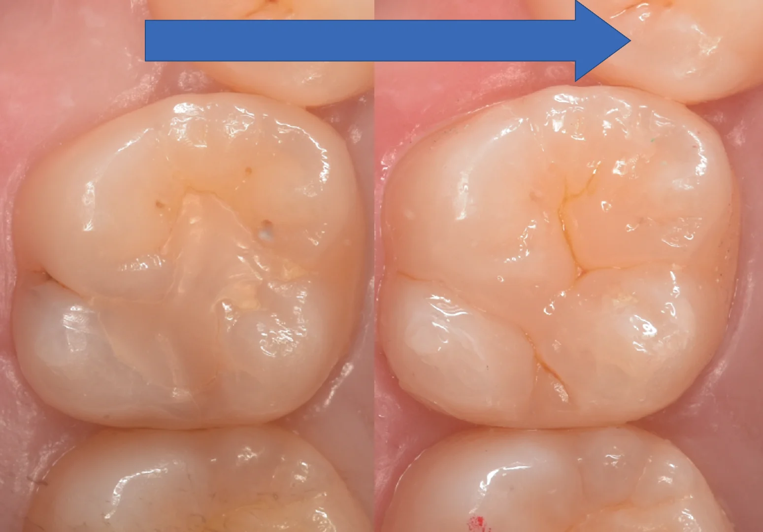 浦安からお越しの方。｜坂寄歯科医院（取手市藤代） - 画像8