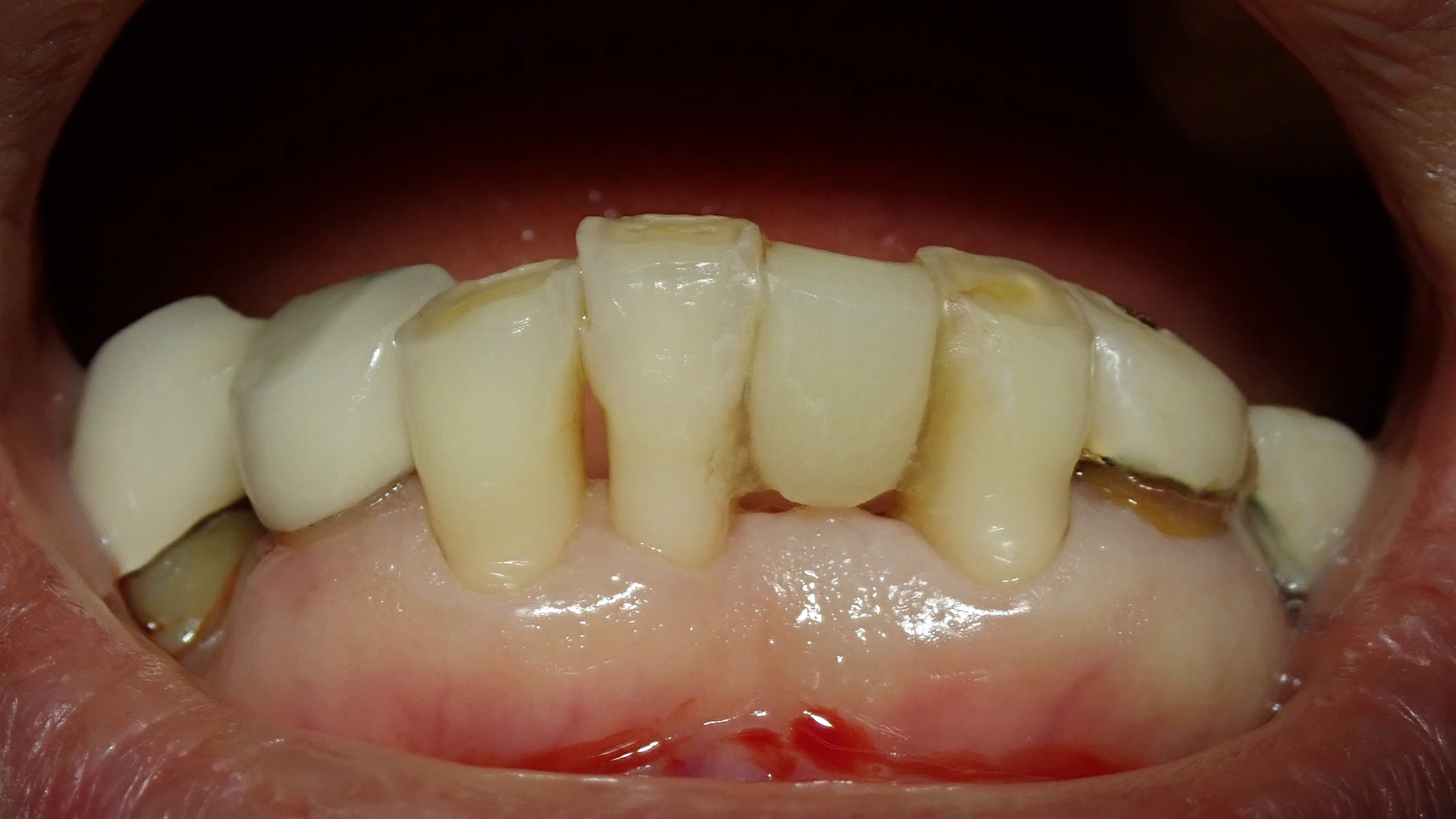 ブログ・お役立ち情報｜坂寄歯科医院（取手市藤代）