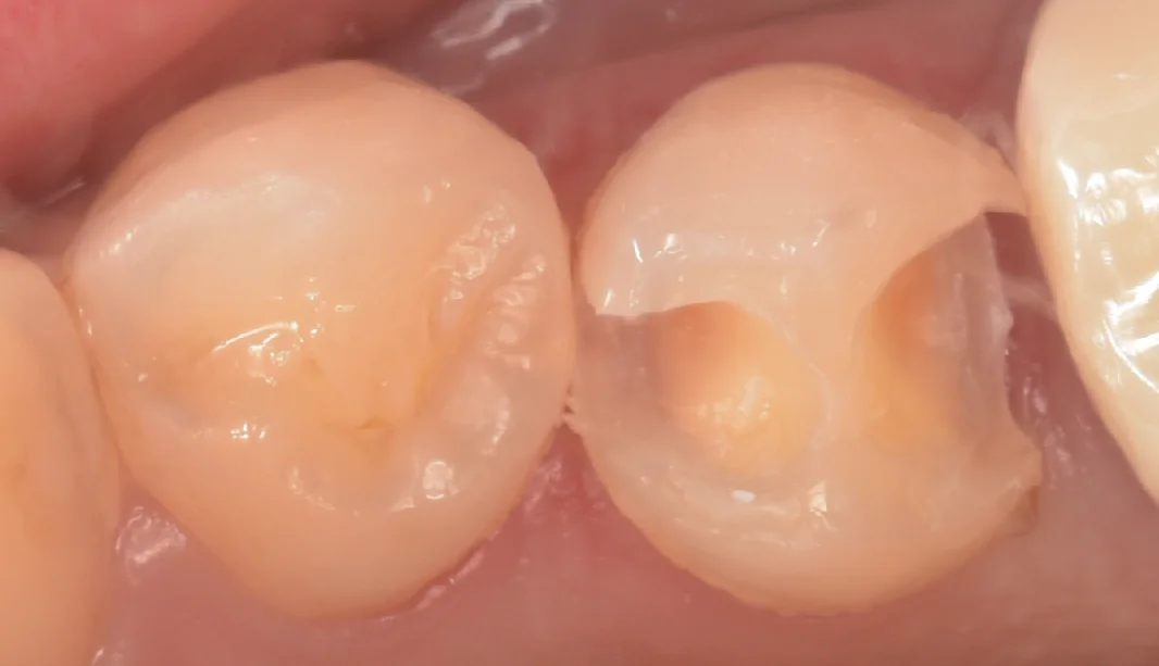 東京都からお越しの方｜坂寄歯科医院（取手市藤代） - 画像2