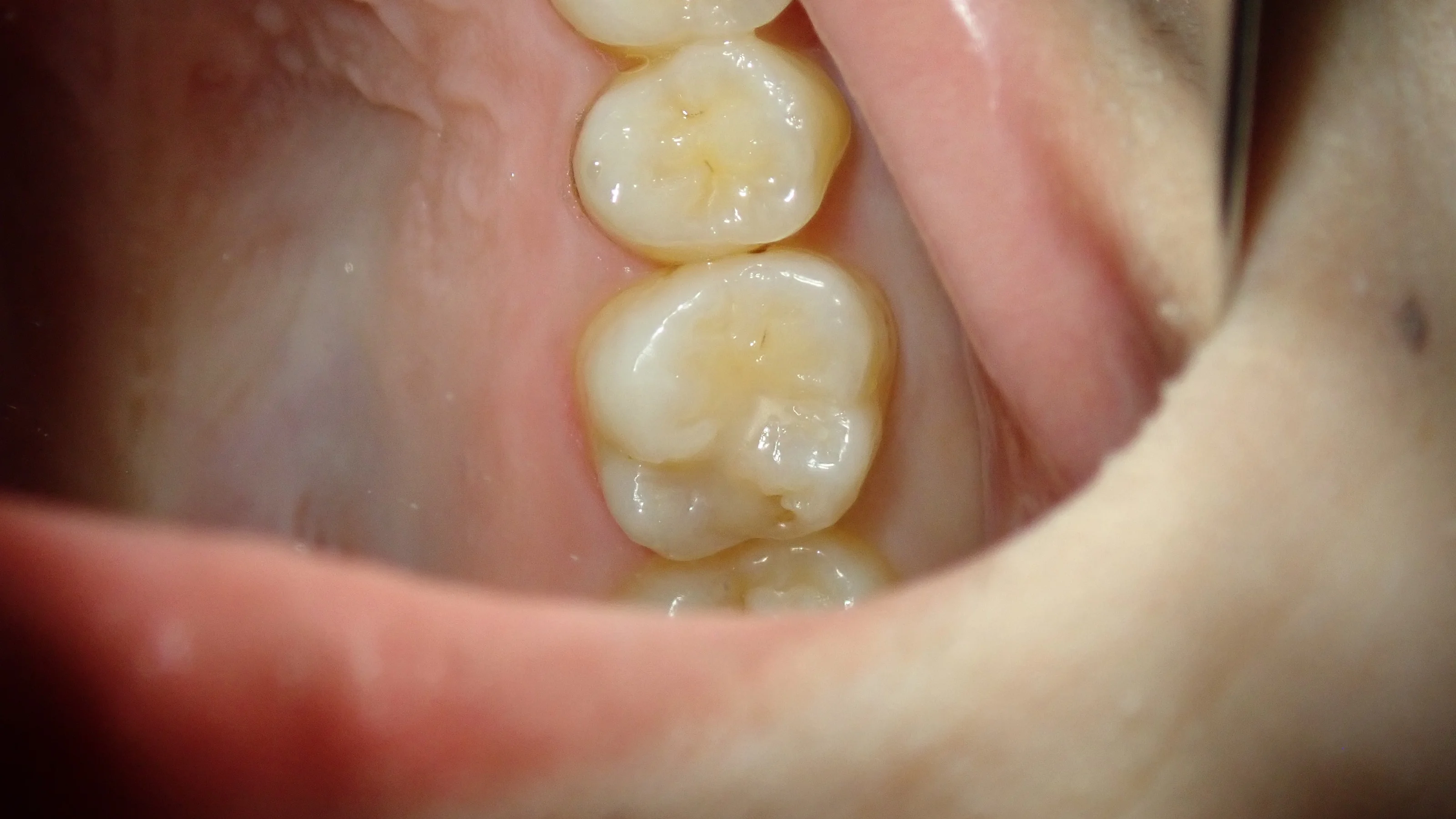 ブログ・お役立ち情報｜坂寄歯科医院（取手市藤代）