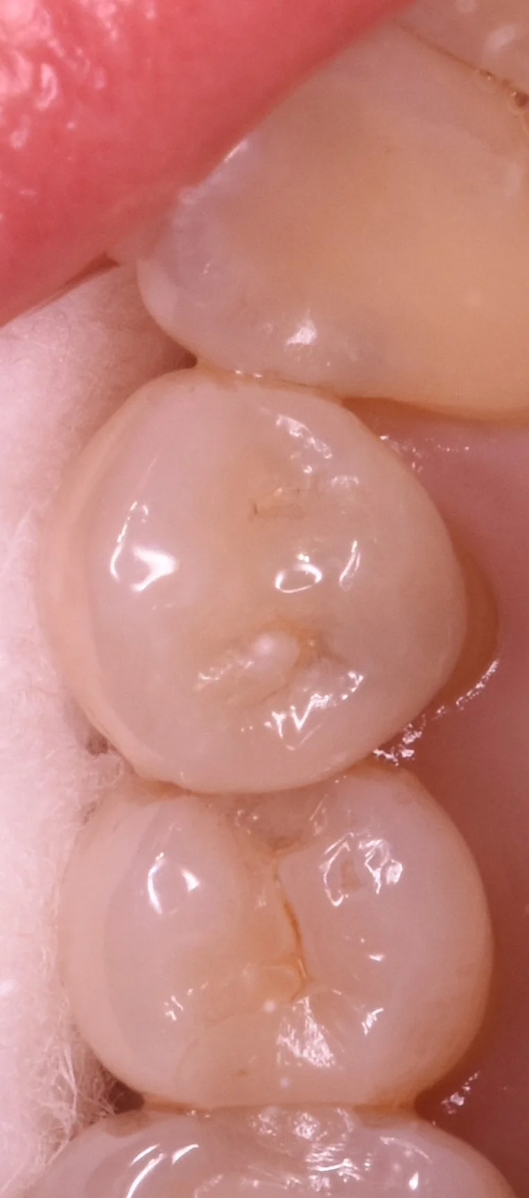 ブログ・お役立ち情報｜坂寄歯科医院（取手市藤代）