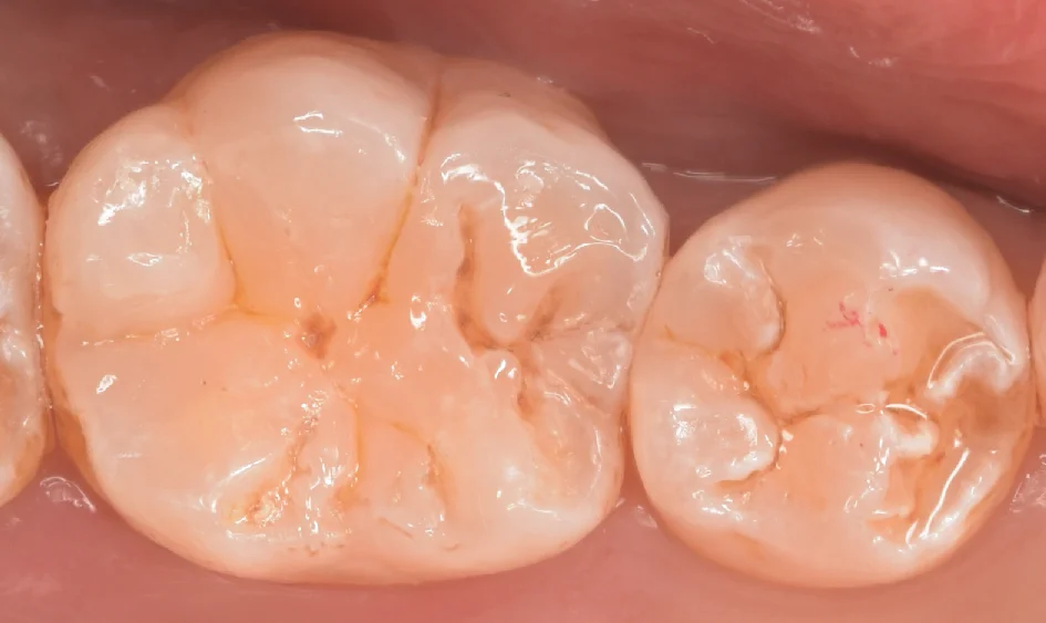 神奈川県からお越しの方｜坂寄歯科医院（取手市藤代） - 画像5