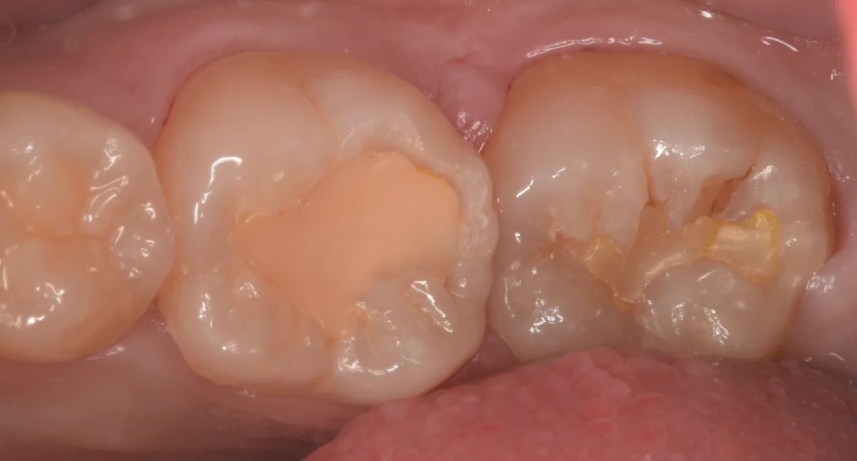 ブログ・お役立ち情報｜坂寄歯科医院（取手市藤代）