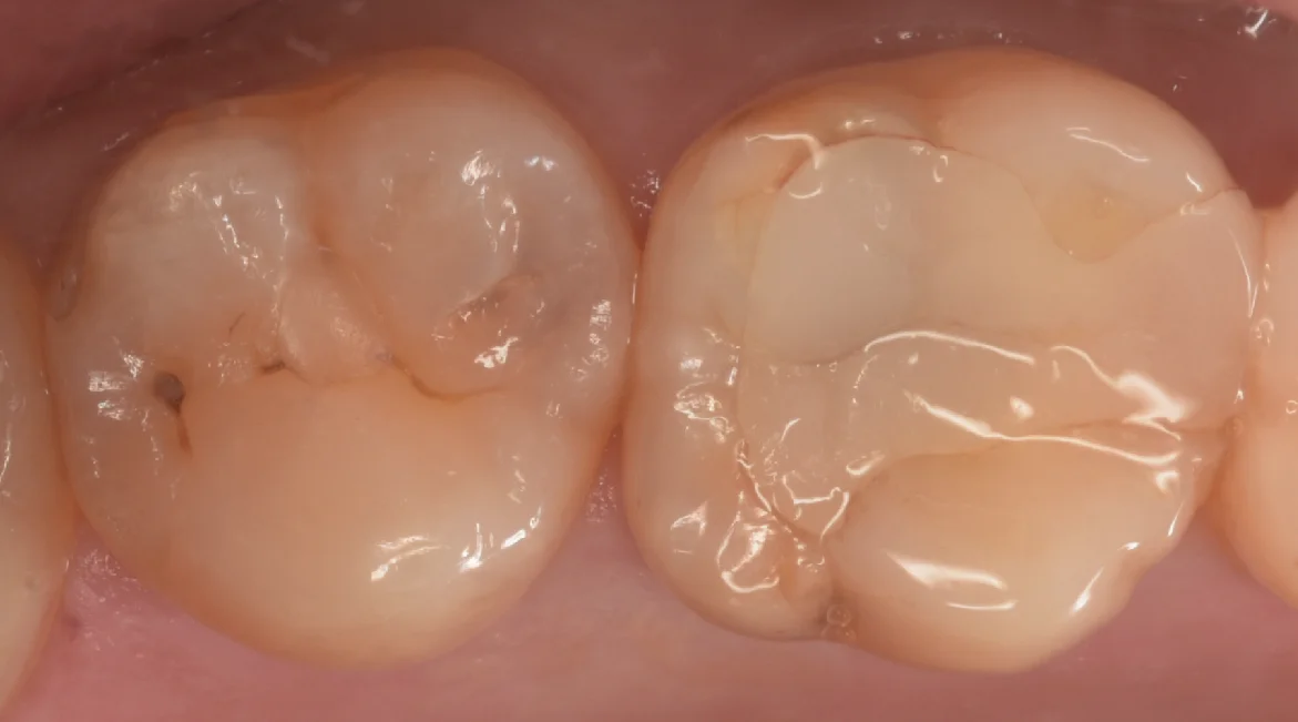 ブログ・お役立ち情報｜坂寄歯科医院（取手市藤代）