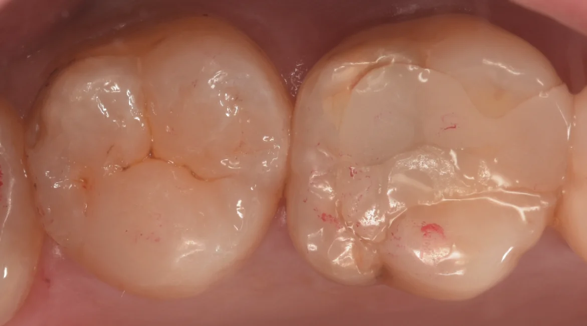 他県より来院された方。｜坂寄歯科医院（取手市藤代） - 画像4