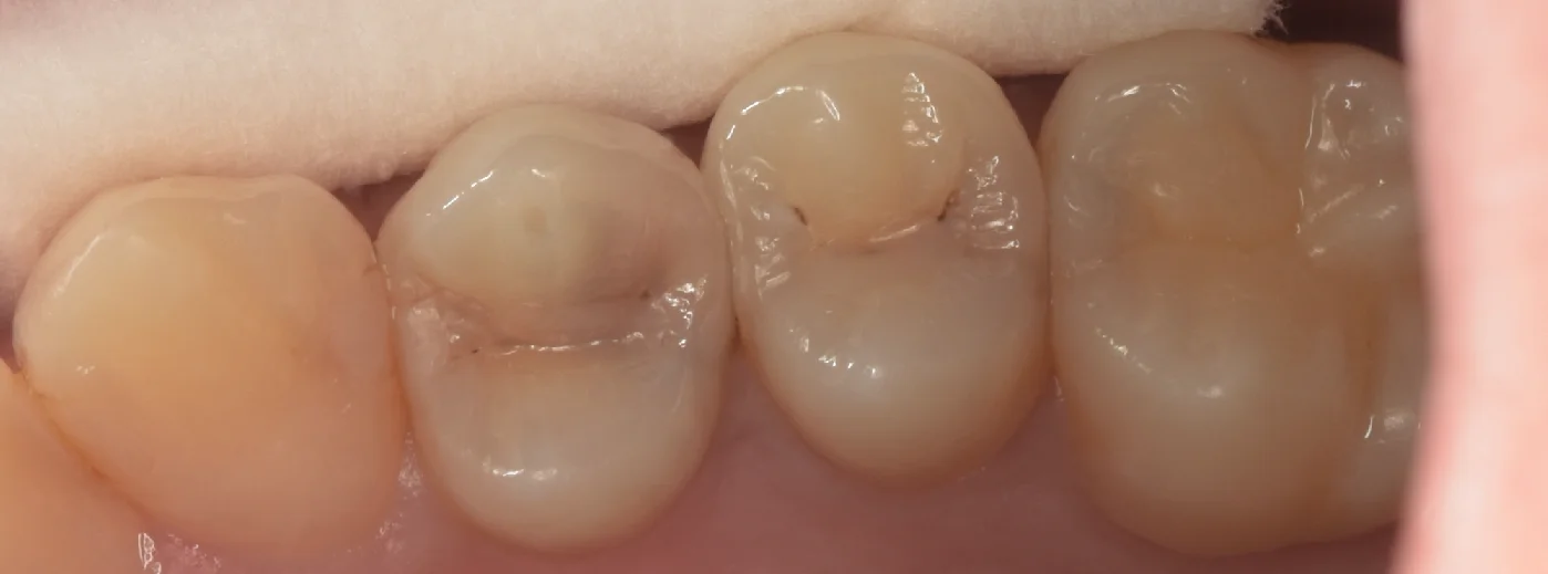 ブログ・お役立ち情報｜坂寄歯科医院（取手市藤代）