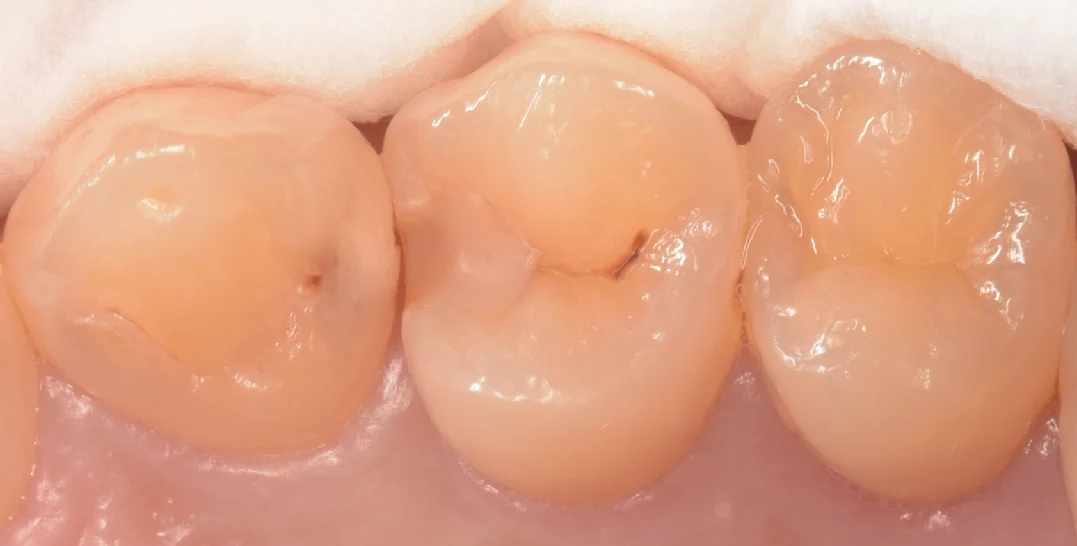 ブログ・お役立ち情報｜坂寄歯科医院（取手市藤代）