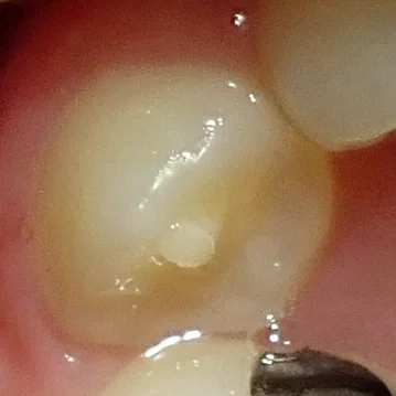 ブログ・お役立ち情報｜坂寄歯科医院（取手市藤代）