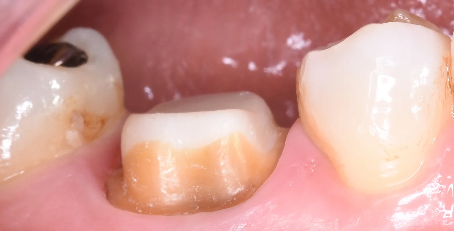 ブログ・お役立ち情報｜坂寄歯科医院（取手市藤代）