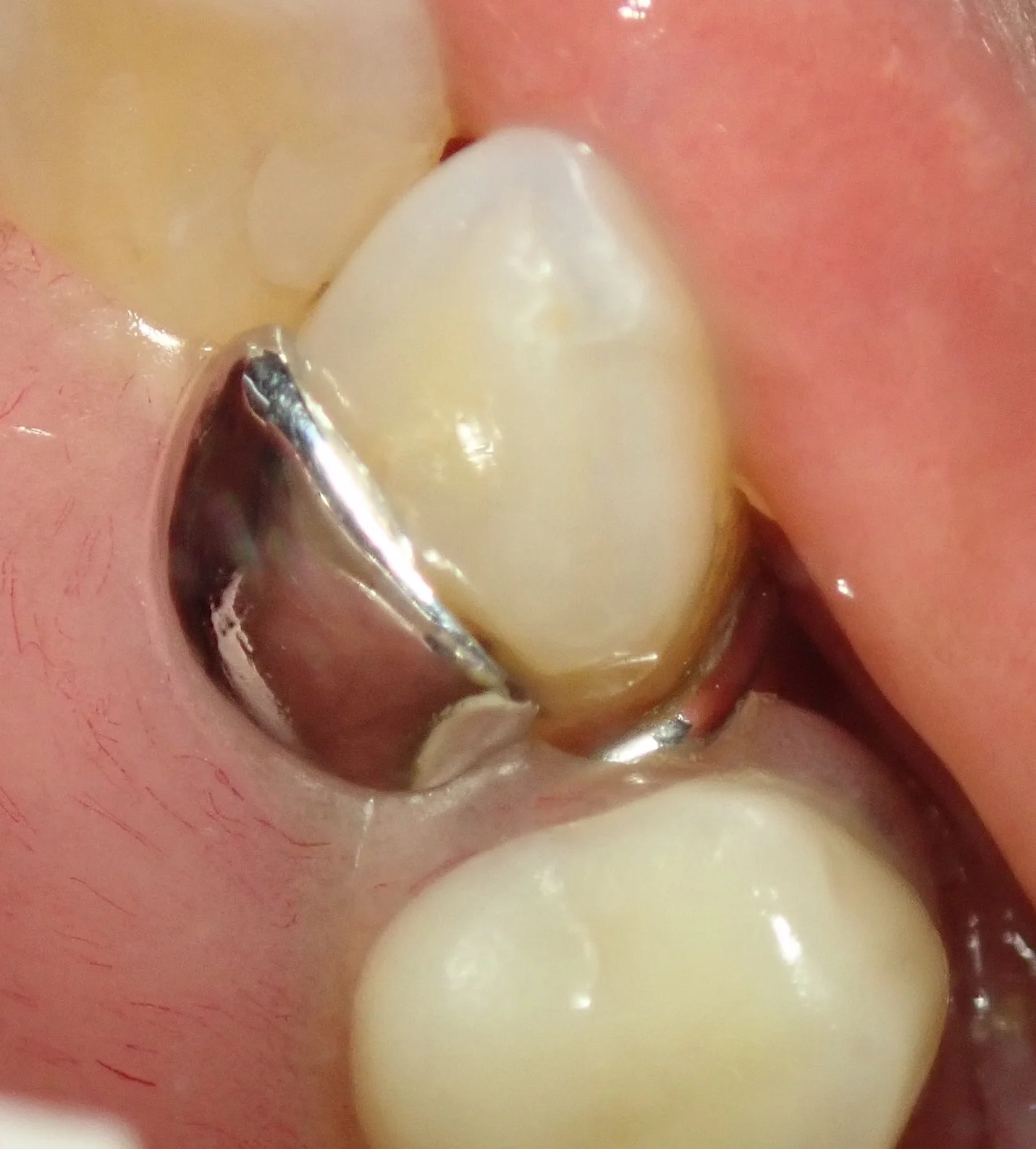 ブログ・お役立ち情報｜坂寄歯科医院（取手市藤代）