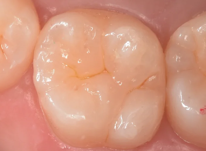 浦安からお越しの方。｜坂寄歯科医院（取手市藤代） - 画像7