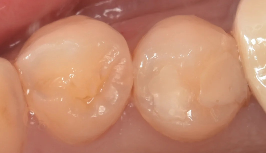 ブログ・お役立ち情報｜坂寄歯科医院（取手市藤代）