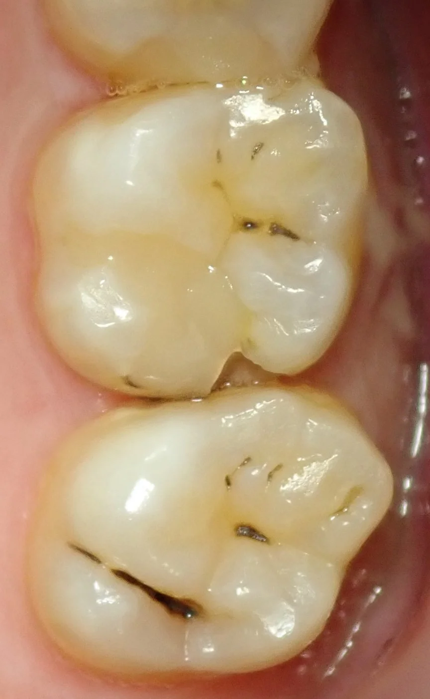 ブログ・お役立ち情報｜坂寄歯科医院（取手市藤代）