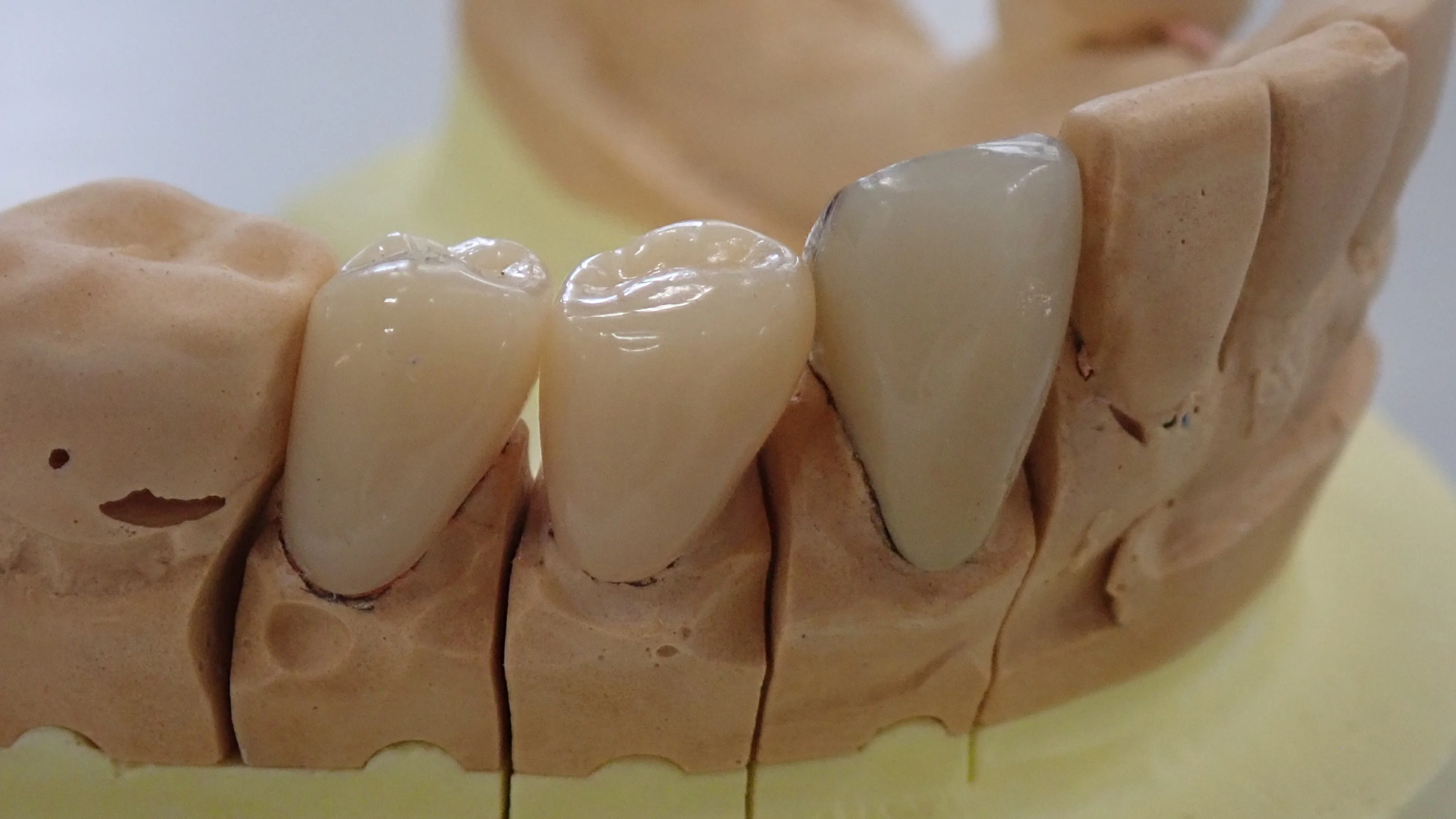 ブログ・お役立ち情報｜坂寄歯科医院（取手市藤代）