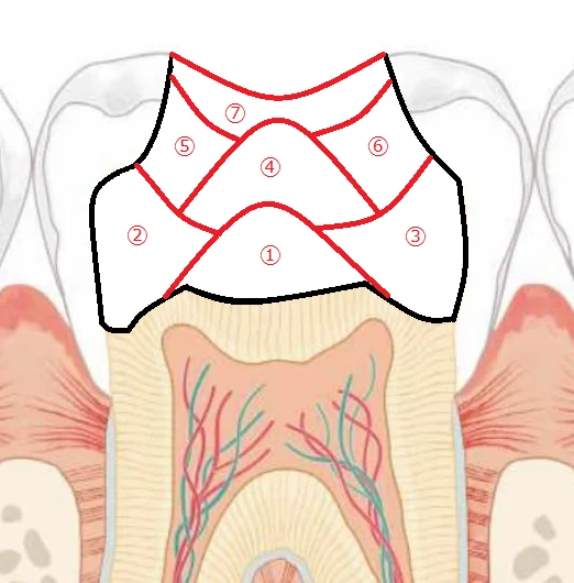 【歯科医師向け】重合収縮のコントロールについて【1級窩洞編】｜坂寄歯科医院（取手市藤代） - 画像8