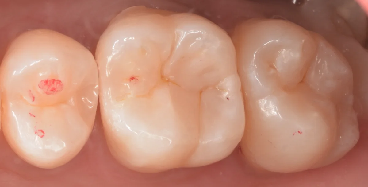 印西市からお越しの方。｜坂寄歯科医院（取手市藤代） - 画像4