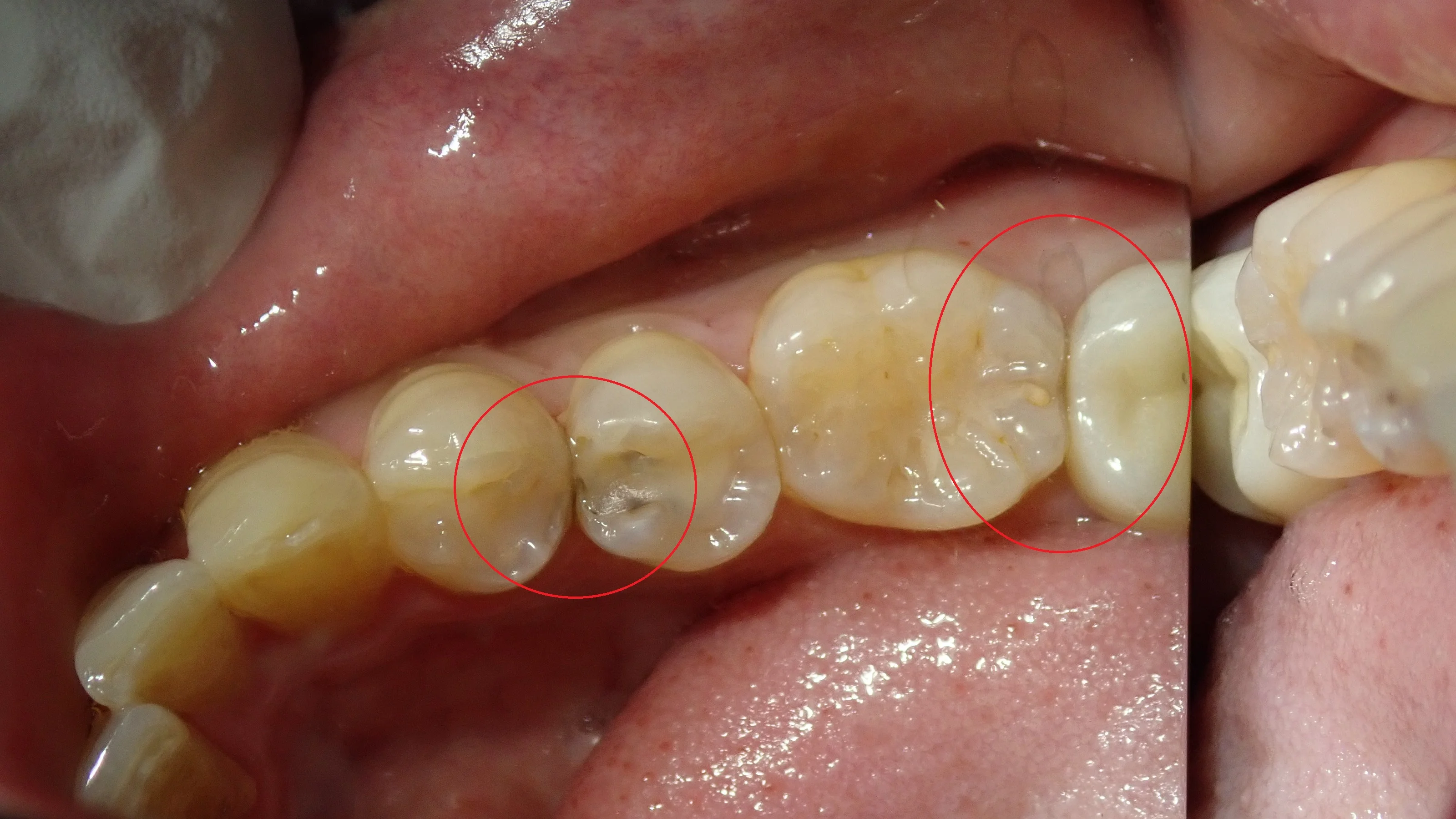 ブログ・お役立ち情報｜坂寄歯科医院（取手市藤代）
