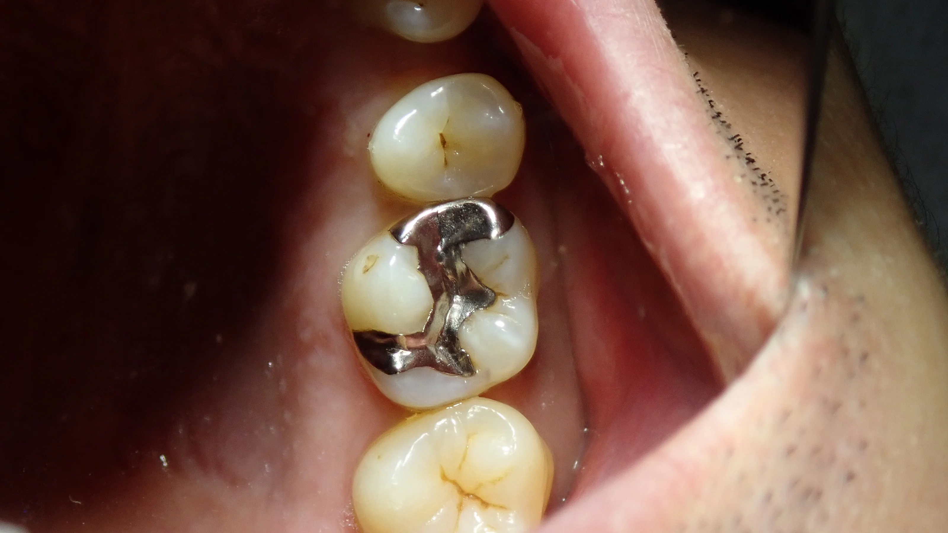 ブログ・お役立ち情報｜坂寄歯科医院（取手市藤代）