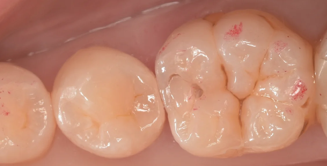 東京都内よりお越しの方をダイレクトで。｜坂寄歯科医院（取手市藤代） - 画像4