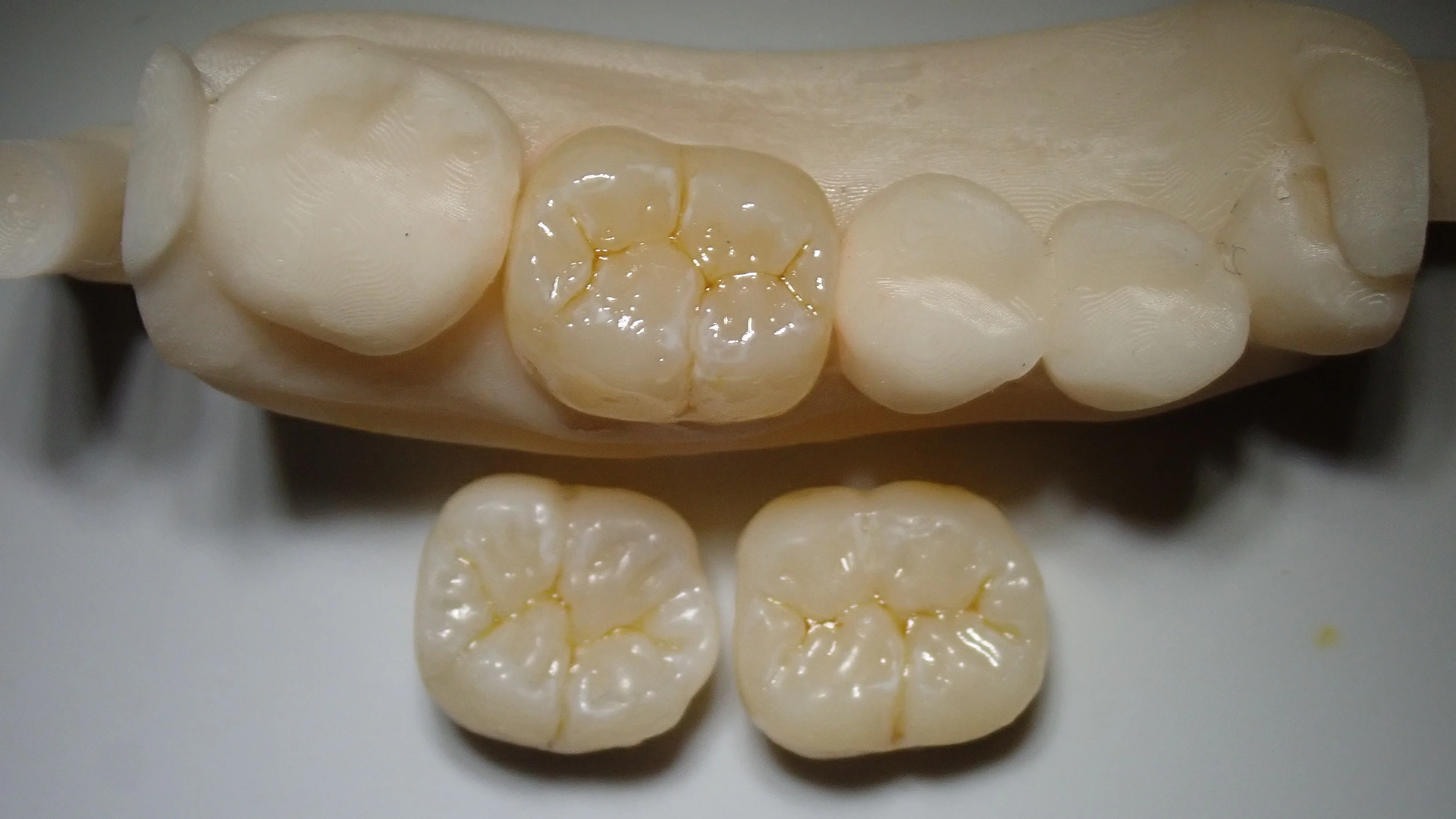 ブログ・お役立ち情報｜坂寄歯科医院（取手市藤代）