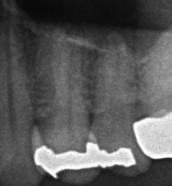 ブログ・お役立ち情報｜坂寄歯科医院（取手市藤代）