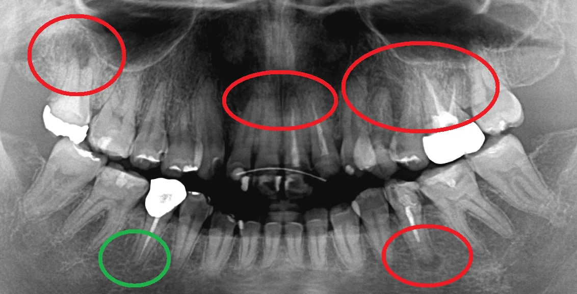 ブログ・お役立ち情報｜坂寄歯科医院（取手市藤代）