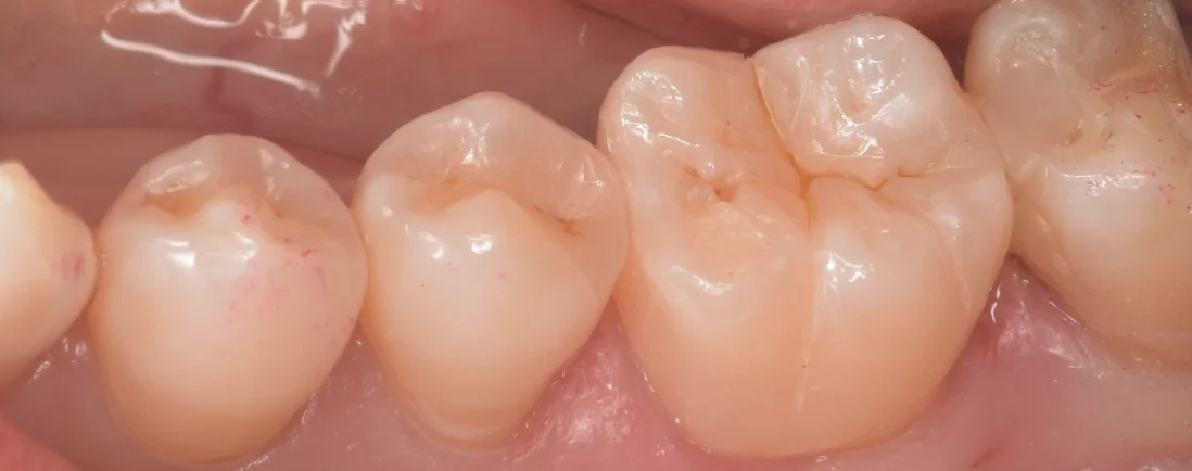 三鷹より来院された方｜坂寄歯科医院（取手市藤代） - 画像8