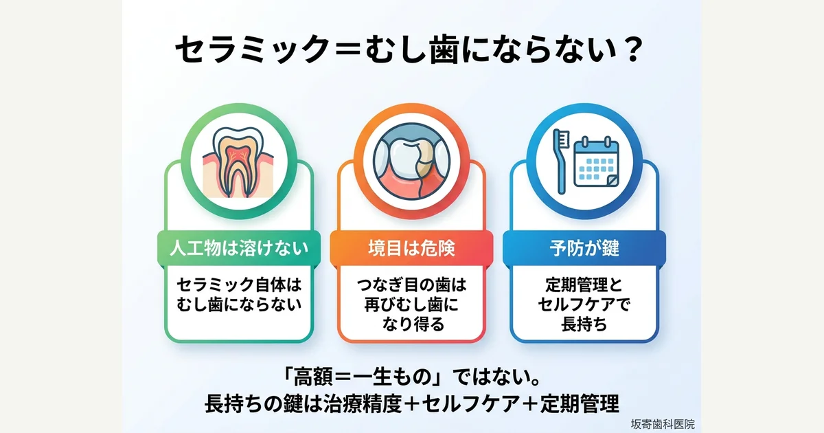 「セラミックはむし歯にならない」は本当？歯科医師がエビデンスで解説